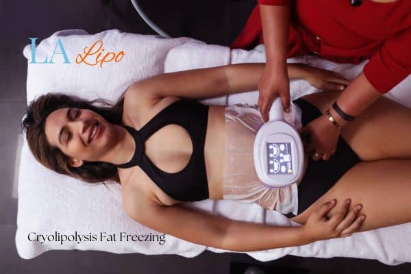 woman getting cryolipolysis Cleveleys