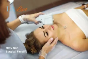 Woman having Hi-Fu to reduce wrinkles Cleveleys.