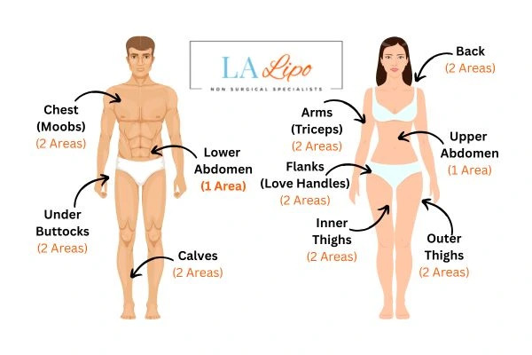 LA LIPO Cryolipolysis Areas Cleveleys