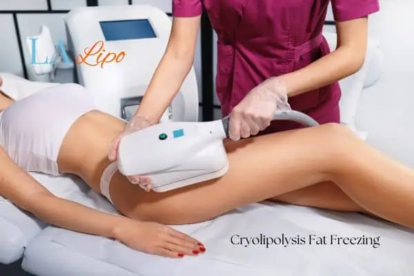 Woman receiving coolsculpting Cleveleys treatment on her thighs