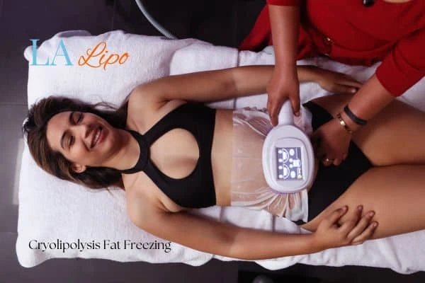 woman getting cryolipolysis Cleveleys