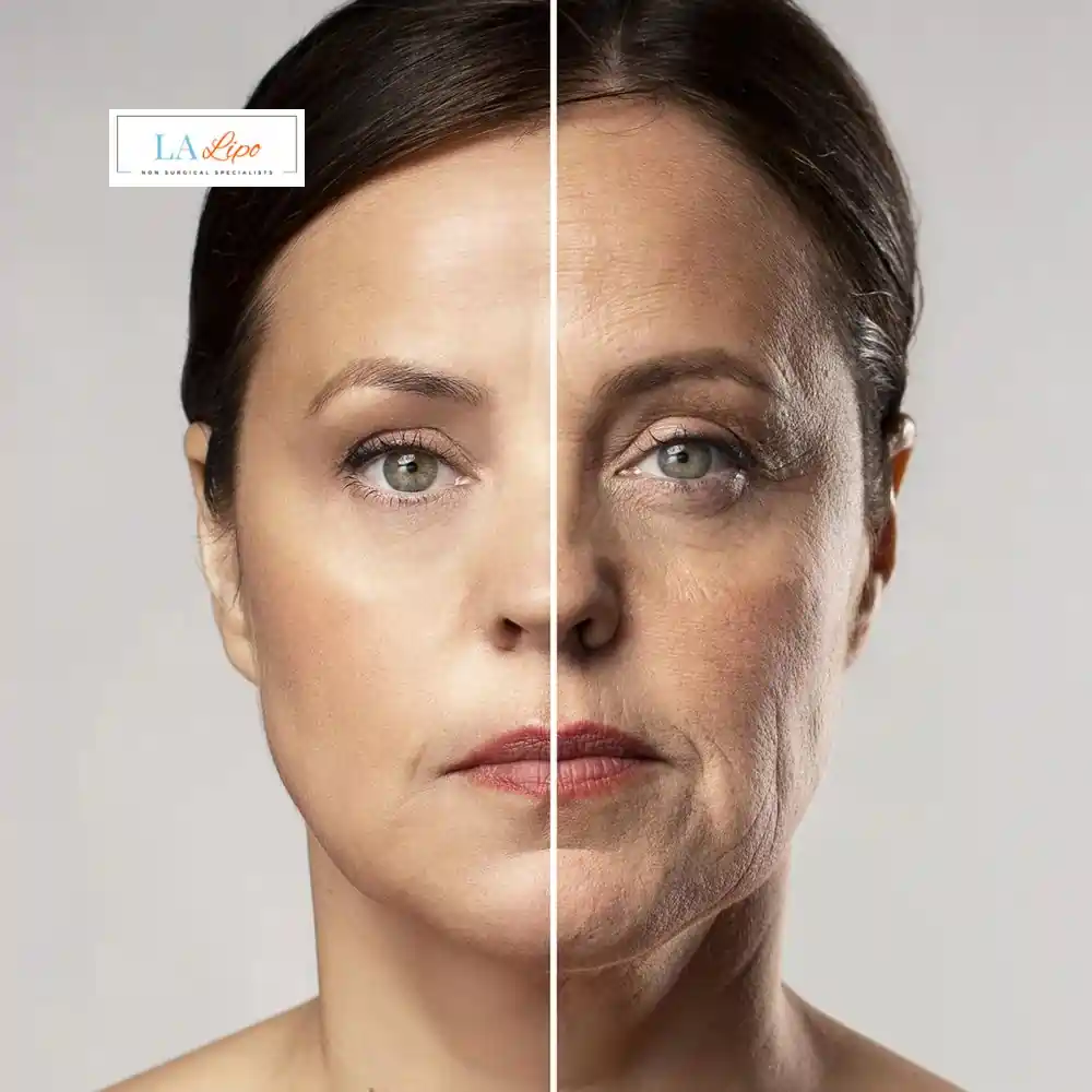 How Can You Tell If Non-Surgical Skin Tightening Is Right for You Cleveleys?