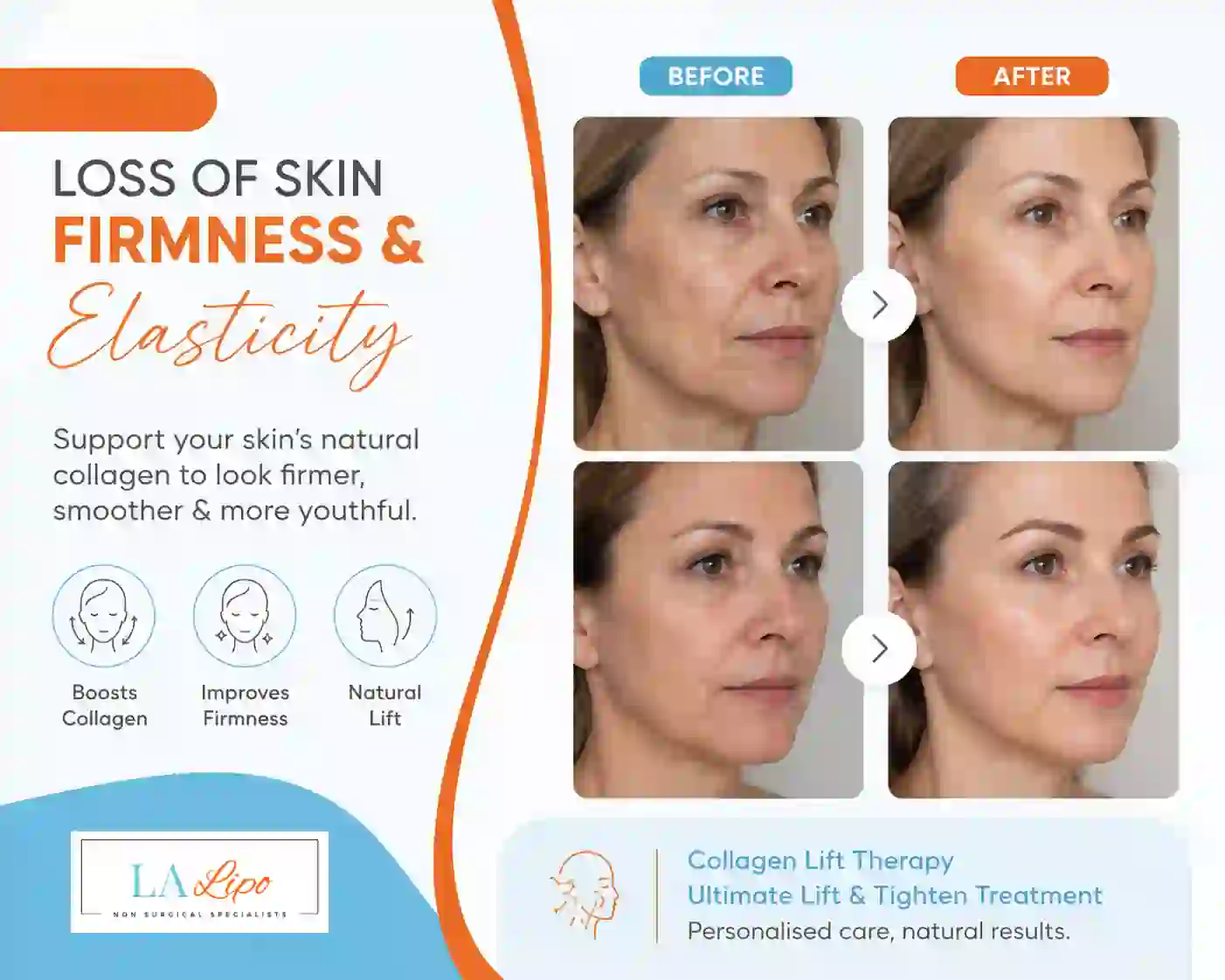 Sign #7: Loss of Skin Firmness and Elasticity Cleveleys