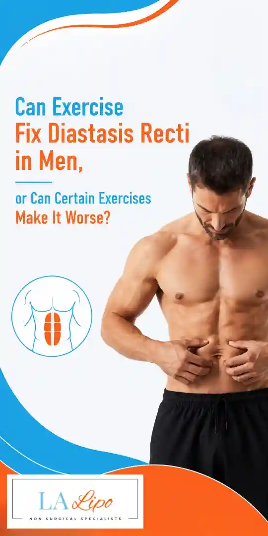 Can Exercise Fix Diastasis Recti in Men, or Can Certain Exercises Make It Worse Cleveleys?